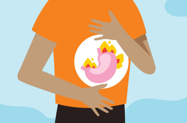 Hearthburn : Mengapa Bisa Terjadi Dan Bagaimana Mengatasinya?
