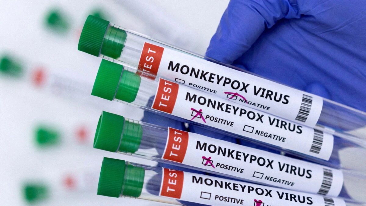 Ilustrasi Pengetesan Virus Monkeypox