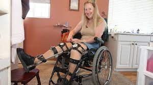 Chloe-Jennings White memakai penyangga kaki dan menggunakan kursi roda, padahal kakinya berfungsi dengan baik 