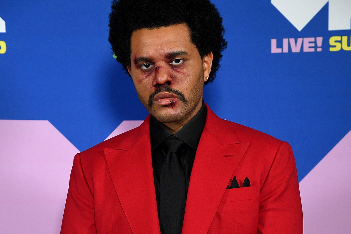 Wajah The Weeknd Berubah Drastis, Operasi Plastikkah?