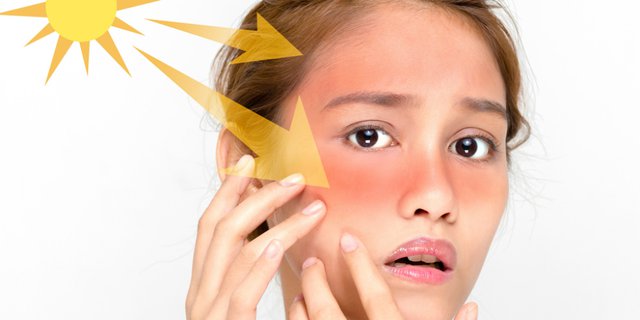 Yuk Pelajari Pentingnya Menggunakan Sunscreen! Bahkan Dapat Menyebabkan Kanker Juga Loh